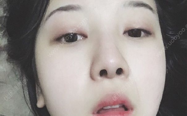 BB霜用什么卸妝？BB霜卸妝水能卸干凈嗎？(2)