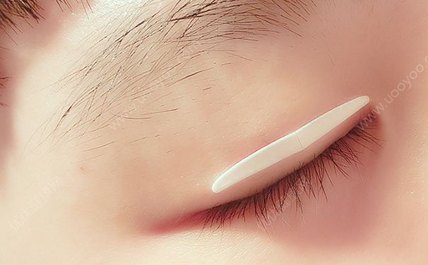 睡覺(jué)能貼雙眼皮貼嗎？睡覺(jué)貼雙眼皮貼可以嗎？(1)