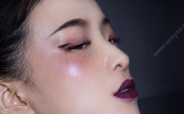 臉上長(zhǎng)雀斑怎么去掉？臉上長(zhǎng)雀斑怎么辦？(6)