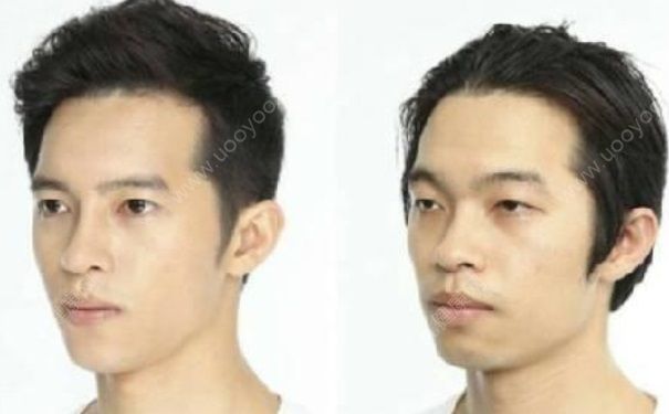 韓女星鼻子塌陷 整容后遺癥有哪些？(2)