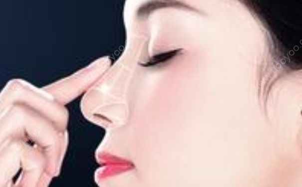玻尿酸隆鼻能保持多久？玻尿酸隆鼻多久消腫？(1)