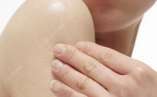 秋季皮膚瘙癢怎么辦？怎么緩解秋季皮膚癢？(1)