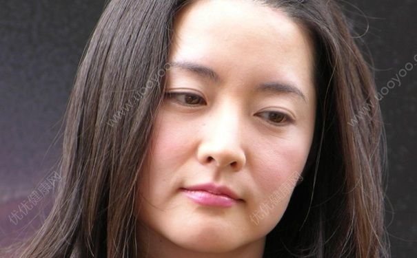 臉部肥胖的原因有哪些？臉部肥胖怎么辦？(1)