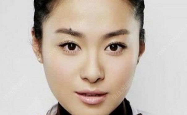 為什么臉上會(huì)長痣？什么原因讓臉上長痣？(3)