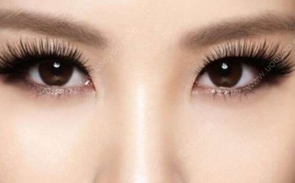 紋美瞳線眼睛會(huì)腫幾天？美瞳線眼睛腫幾天能消腫？(1)