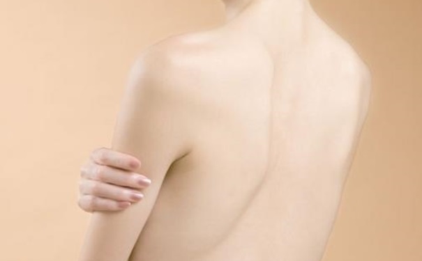 背上的痘疤怎么去？背上的痘印怎么辦？(1)