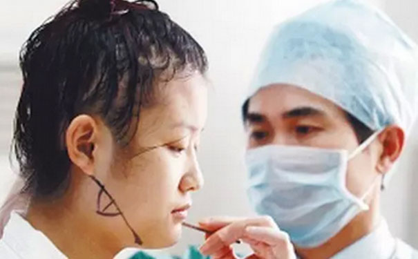 磨顴骨后遺癥有哪些？磨顴骨的危害？(1)