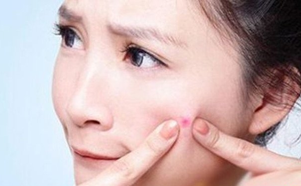 什么護(hù)膚品祛痘最好？祛痘最好的護(hù)膚品？(1)