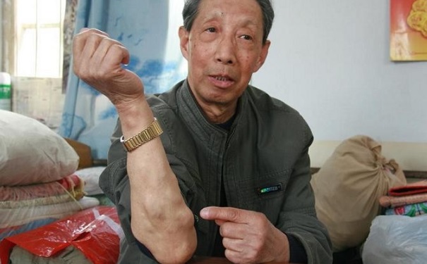 脂肪瘤疼痛是怎么回事？脂肪瘤痛是怎么回事？(1)