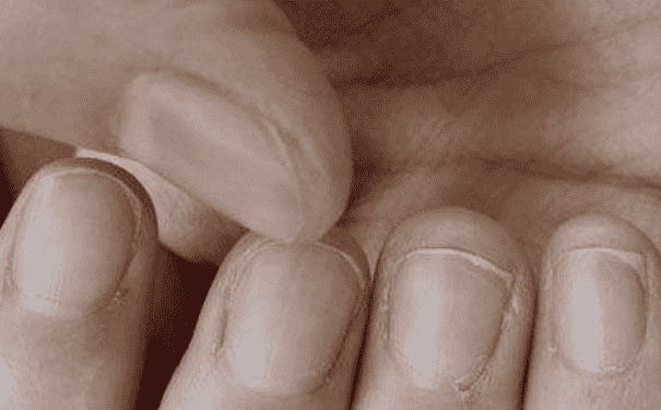 怎樣通過指甲看身體健康狀況？怎樣從指甲看出男人腎虛？(1)