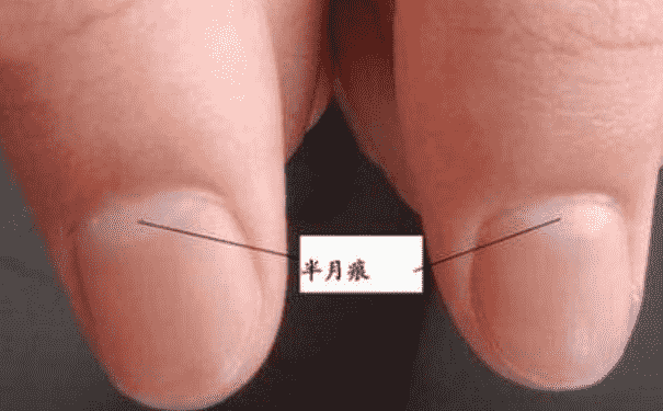 指甲半月痕代表什么？從指甲半月痕看生育能力(1)