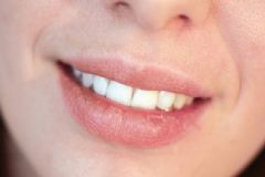 秋季嘴唇干裂還流血？吃這些食物讓你雙唇水潤！[圖]
