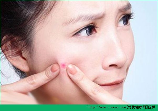 為什么長(zhǎng)痘痘？長(zhǎng)痘痘的原因有哪些？(1)