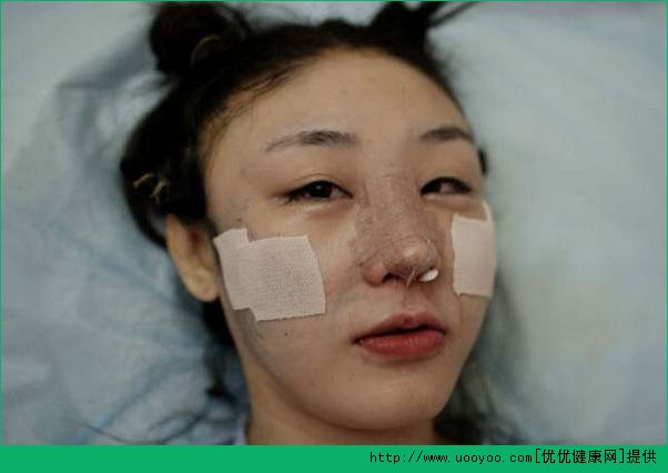 整容上癮怎么辦？整容上癮要怎么調(diào)整心態(tài)？(1)
