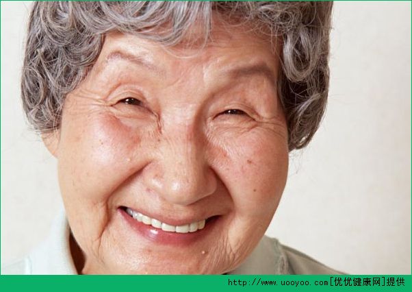 笑會(huì)長(zhǎng)皺紋嗎？笑會(huì)導(dǎo)致老的快嗎？(1)