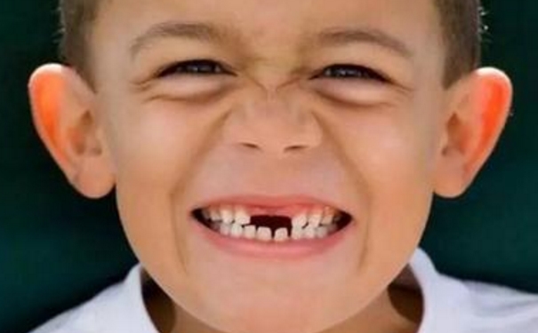 孩子換牙期要注意什么？孩子換牙的時候有什么要注意的地方？(1)