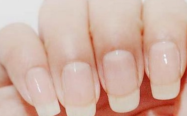 指甲沒(méi)有月牙是哪里不好？指甲沒(méi)有月牙是怎么了？(1)