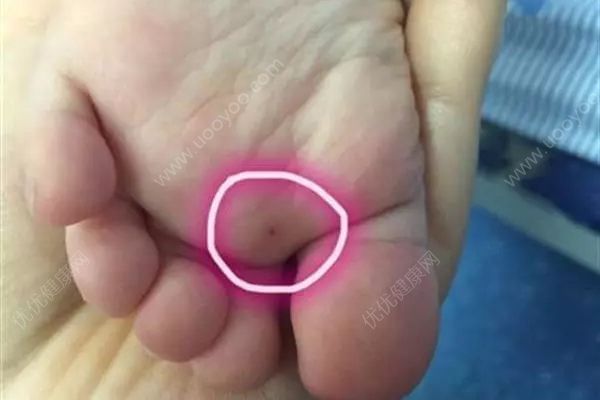兩歲女童獨(dú)自在家午睡，遭破門(mén)而入男子扎針(1)