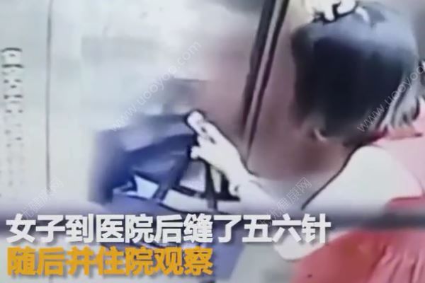 電梯吊頂突然墜落，女子慘被砸破頭，乘坐電梯注意事項(3)