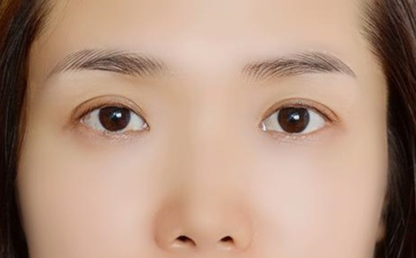 掉眉毛是什么征兆？掉眉毛是什么病的前期表現(xiàn)？(1)
