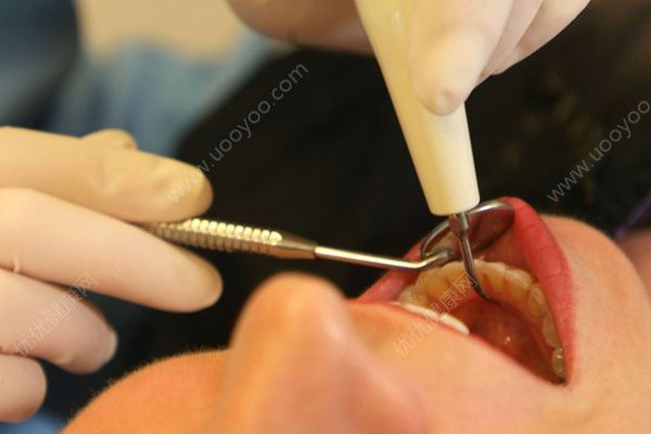 心臟病患者能否拔牙？有心臟病可以拔牙嗎？(1)