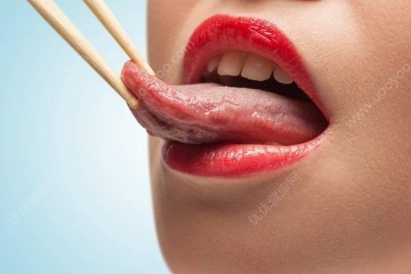 舌頭潰瘍的引起原因是什么？舌頭潰瘍要怎么治療？(2)