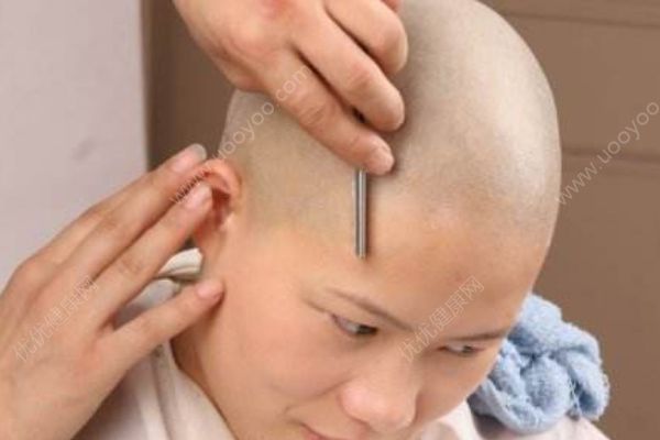 冬天剃光頭會感冒嗎？剃光頭能不能改變發(fā)質(zhì)？(3)