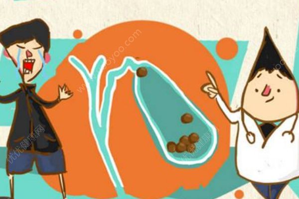 哪些人最容易得膽結(jié)石？膽結(jié)石有哪些明顯特征？(2)