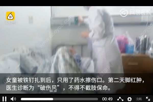 上廁所踩到鐵釘需截肢保命，踩到鐵釘怎么處理？(4)