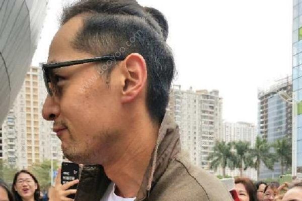 胡歌曬心形發(fā)際線，發(fā)際線后移的原因有哪些？(2)