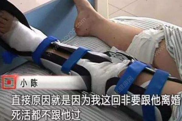 男子不愿離婚割斷妻子腳筋，此前曾砍妻子14刀被拘(1)