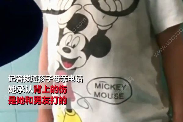 5歲男童因大小便不能控制！遭親媽和其同居男友虐打！(2)