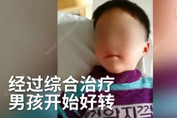 躺著玩手機(jī)太久，男童變歪頭寶寶！(4)