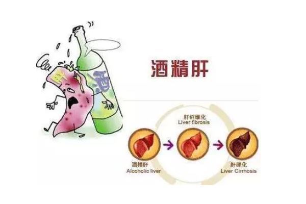 每天半斤白酒，30多歲小伙竟變成“女兒身”，長期飲酒的危害(3)