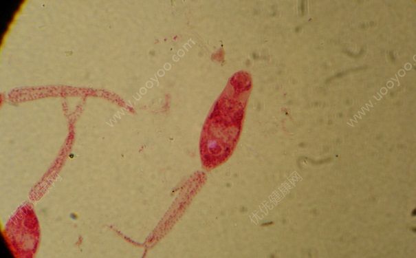 9歲男孩貧血怎么辦？99歲會(huì)出現(xiàn)貧血癥狀嗎？(4)