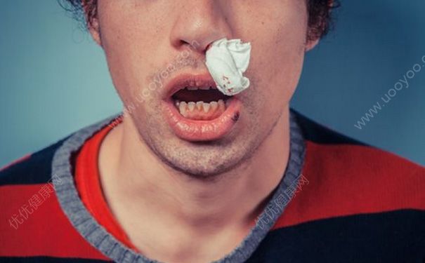 15歲男孩經常流鼻血怎么回事？15歲男孩經常流鼻血怎么辦？(2)