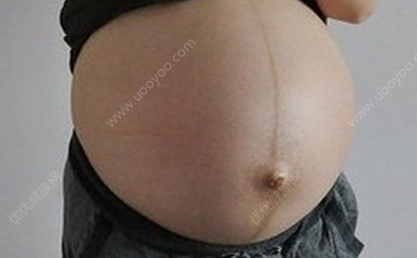 妊娠線什么時(shí)候消失？妊娠線會(huì)自己消失嗎？(1)