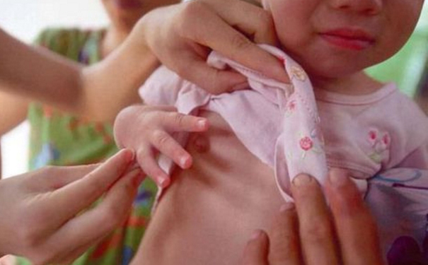 乳房早發(fā)育是什么樣子的？女人乳房早發(fā)育原因？(1)