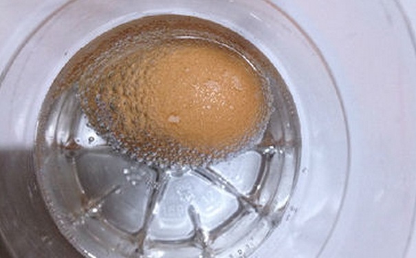 白醋泡雞蛋有什么好處？雞蛋泡醋有什么功效？(1)