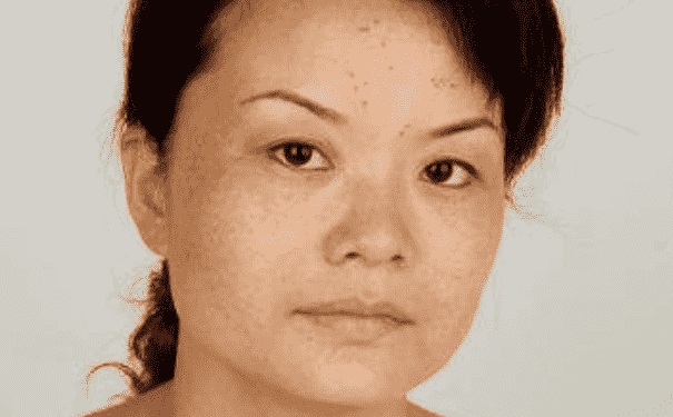 女人內(nèi)分泌失調(diào)的危害有哪些？女人內(nèi)分泌失調(diào)有哪些危害？(1)