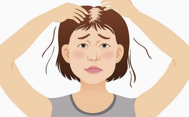 脫發(fā)應(yīng)該怎樣治療？女性脫發(fā)有何危害？(1)