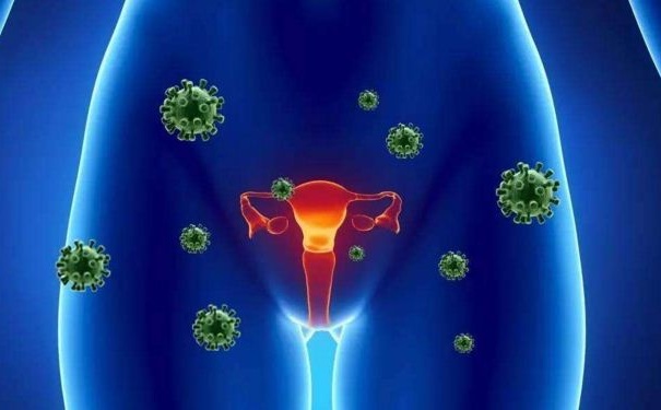 婦科腫瘤有何癥狀？婦科腫瘤如何預(yù)防？(1)