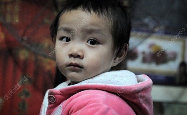冬天嘴唇發(fā)紫怎么辦？冬天嘴唇發(fā)紫是什么原因？(2)