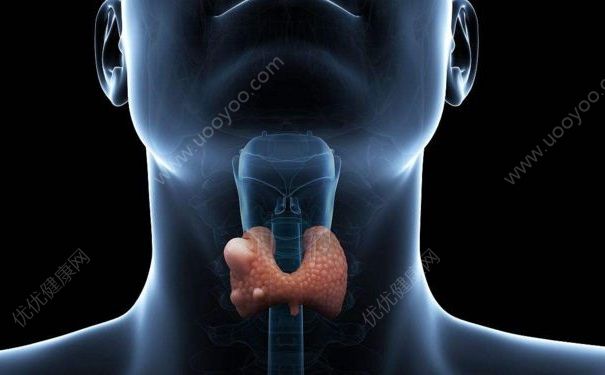 甲狀腺癌有何癥狀？甲狀腺癌怎么治療？(3)