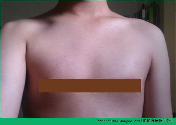 13歲男生胸大怎么辦？男生胸部有硬塊正常嗎？(1)