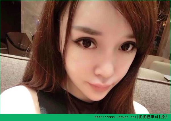 14歲整容會怎樣？整容對生活影響大嗎？(4)
