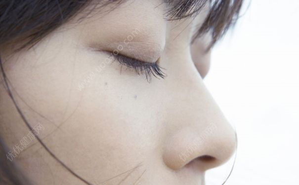眼睛睜不開怎么辦？眼睛睜不開是怎么回事？(1)