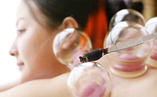 拔罐多久拔一次好？幾天拔罐一次好？(1)
