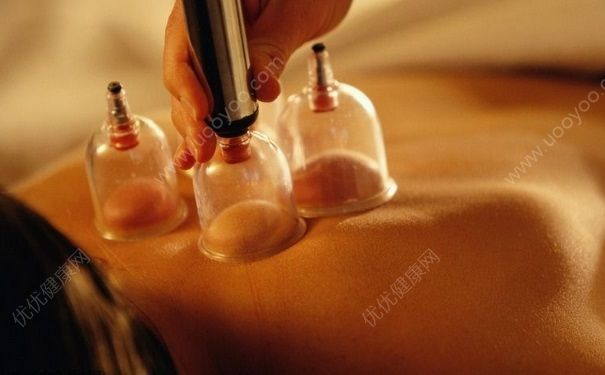 拔罐后疼痛正常嗎？拔火罐后疼是怎么回事？(1)