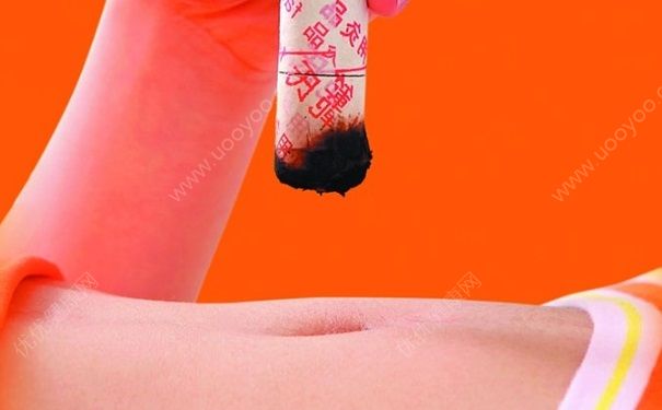 輸卵管堵塞艾灸哪里？輸卵管堵塞灸哪個部位？(1)